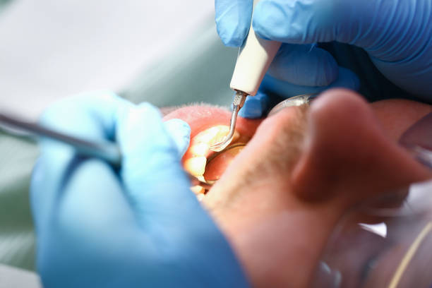 Best Cracked Tooth Emergency Dentist  in Woodside, PA